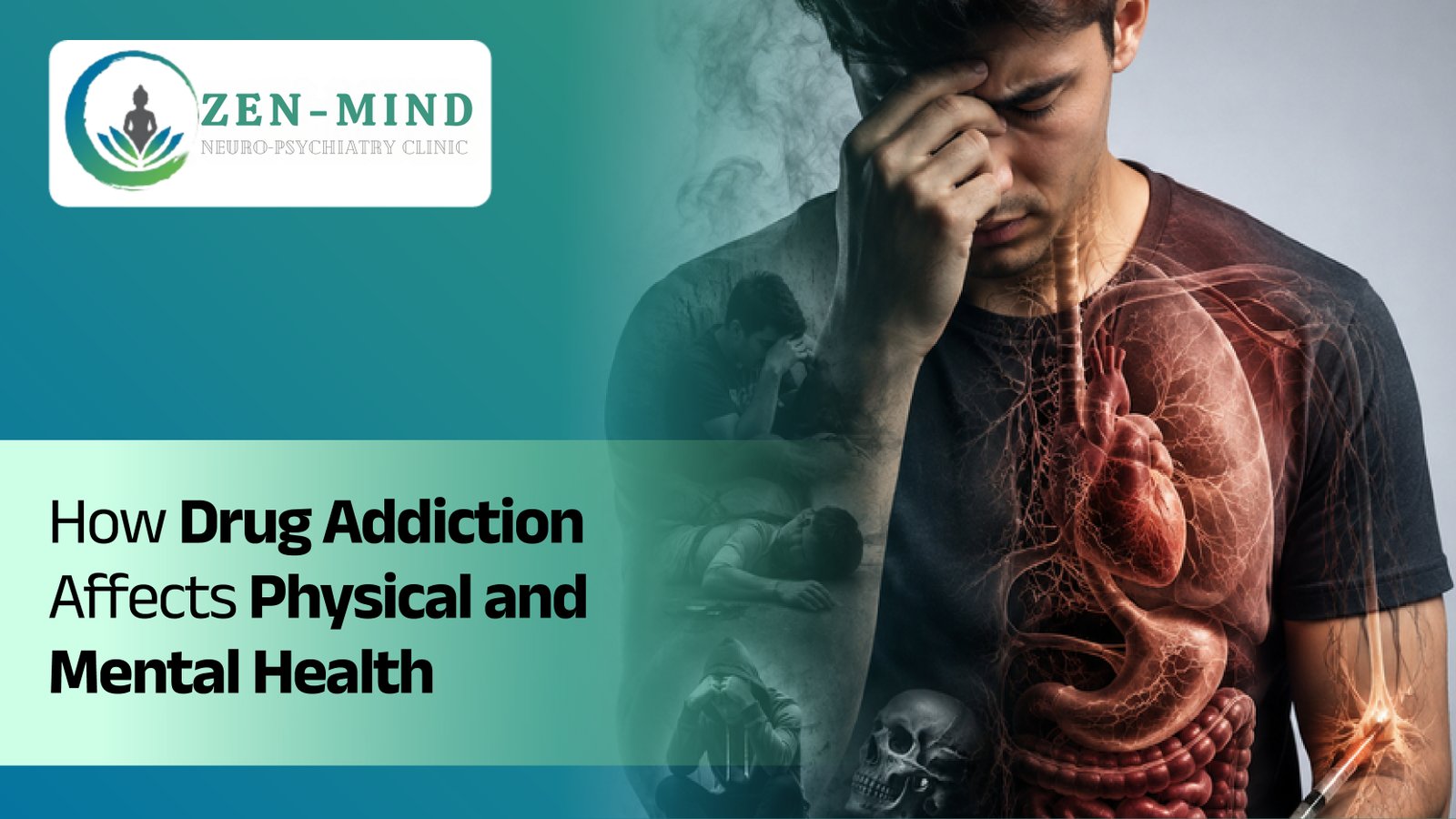 How Drug Addiction Affects Physical and Mental Health