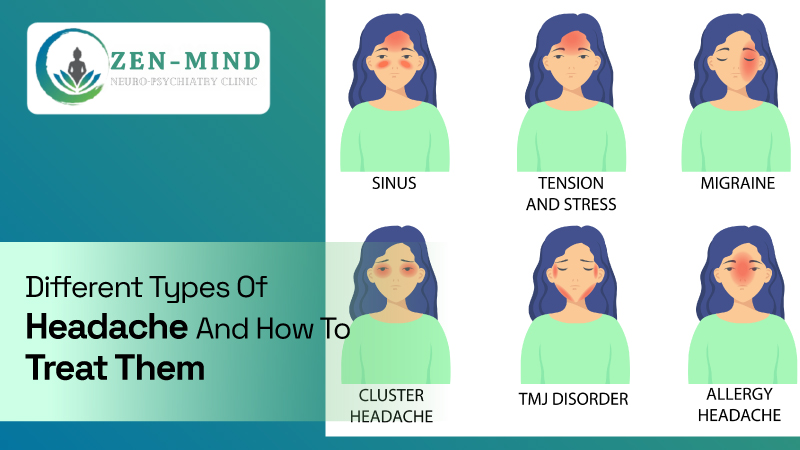 Types Of Headache Types Of Headache